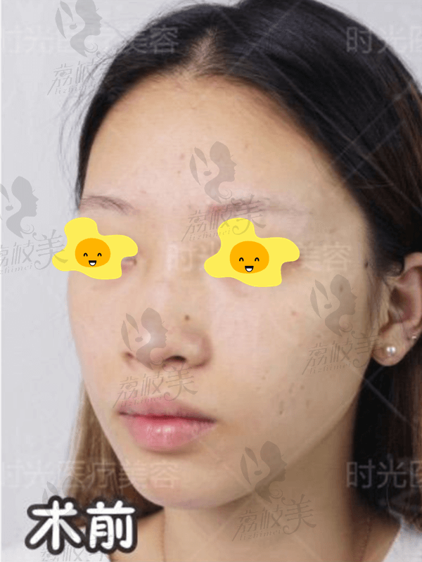 手术前