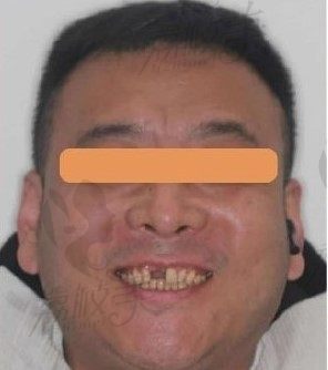 手术前