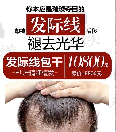 荆州华美发际线种植价格10800元起,FUE精细技术让您拥有浓密头发