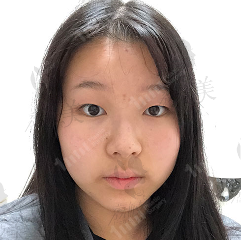 手术前