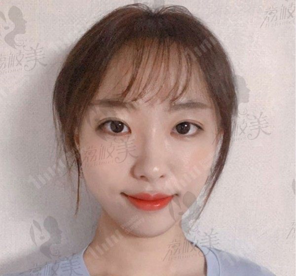 韩国1mm妈生自然款双眼皮，遮瞳无神变身大眼萌妹！
