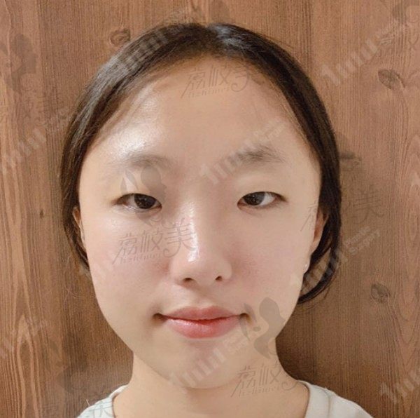 手术前