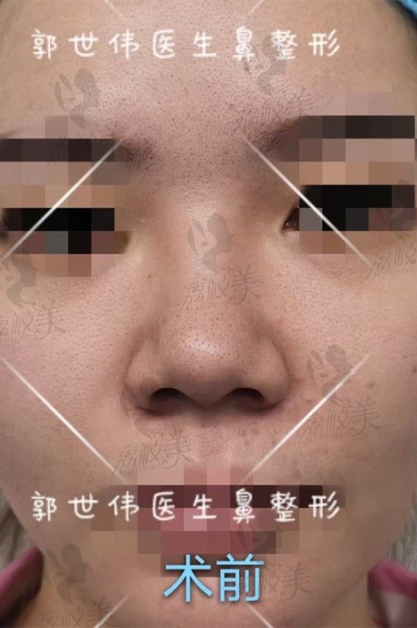 手术前