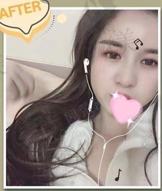 手术前