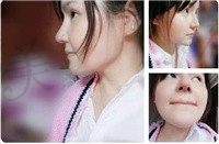 手术前
