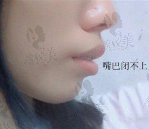手术前