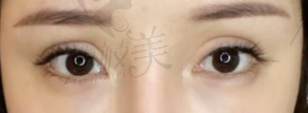 手术前