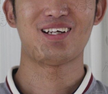 手术前