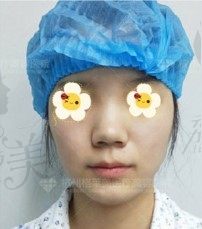 手术前