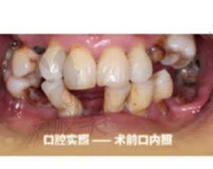 手术前