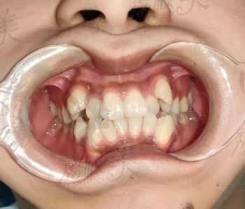 手术前