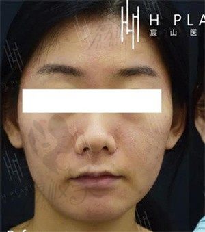 手术前