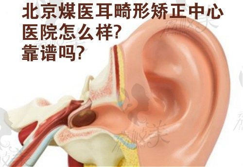 北京煤医耳畸形矫正中心怎么样?郭志华的假体生物支架耳再造效果好不好