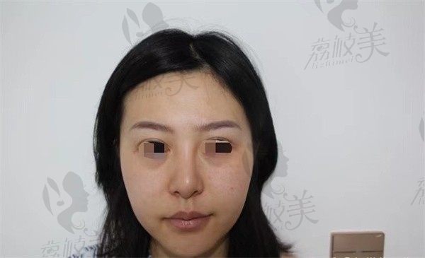 手术前