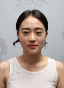 手术前