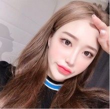 韩国奥森博整形眼修复+鼻综合+面部脂肪填充+瘦下巴前后效果对比惊人！