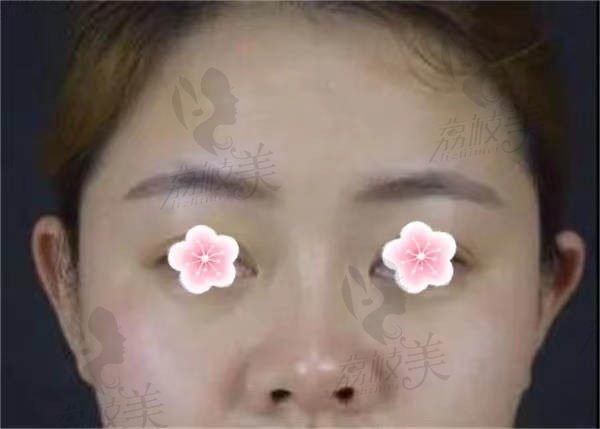 手术前