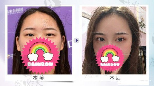 手术前
