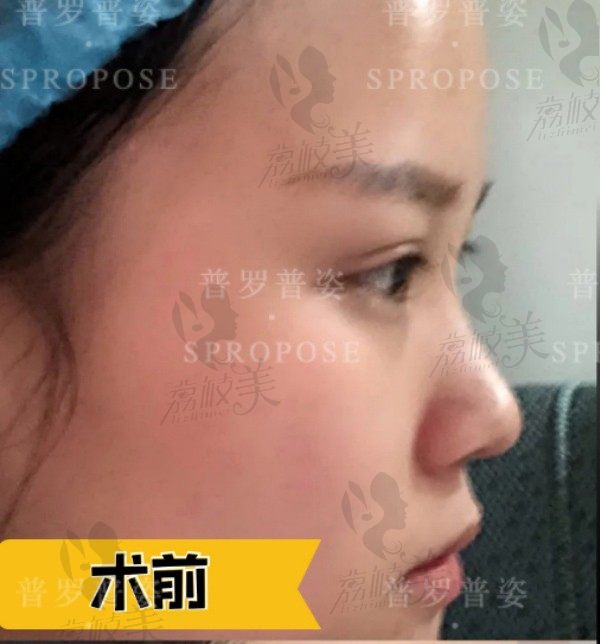 手术前