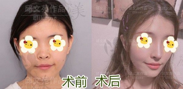 手术前