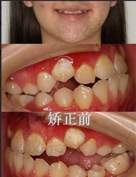 手术前