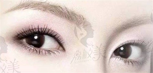 福州海峡薛克墘做眼综合技术好，翘睫美瞳术双眼皮定制一站式美眼