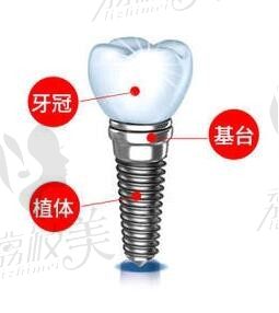 上海种植牙医生排名,都是上海种植牙医院排行榜里的好医生