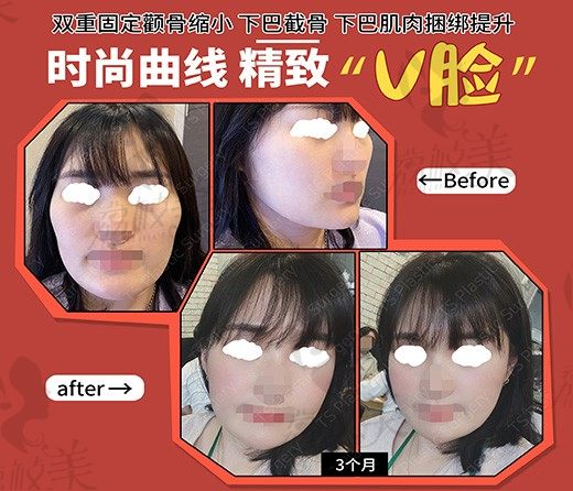 韩国TS整形医院，定制我的专属美丽！