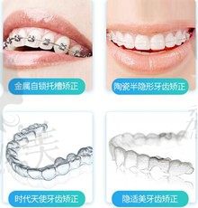 深圳牙套多少钱一副,隐形牙套和钢丝牙套价格差异大吗