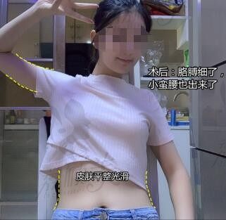 坐标江苏抽脂，真实全身吸脂经历看南京美贝尔黄名斗抽脂怎么样？