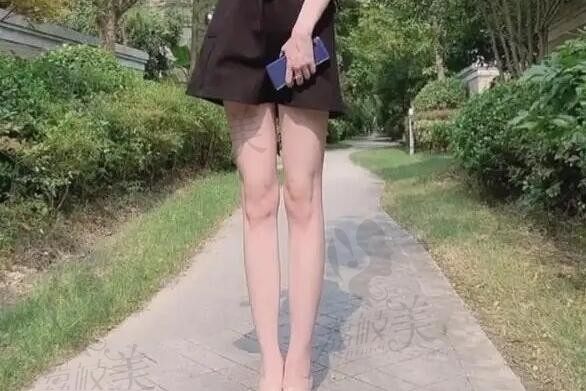 坐标武汉吸脂，真实大腿抽脂经历看仁爱时光的包涛技术怎么样