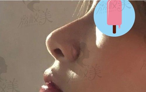 濮阳时光医美怎么样？双眼皮\隆鼻\面部填充项目优势及收费参考