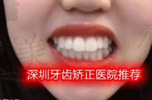 2022年深圳矫正牙齿医院推荐,都是深圳口碑好的口腔牙科诊所