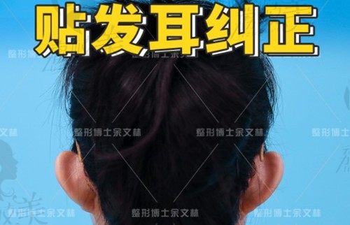 广州高尚余文林做贴发耳技术好,自研缝合技术价格仅16000元起