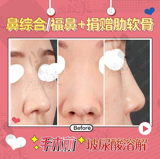 手术前
