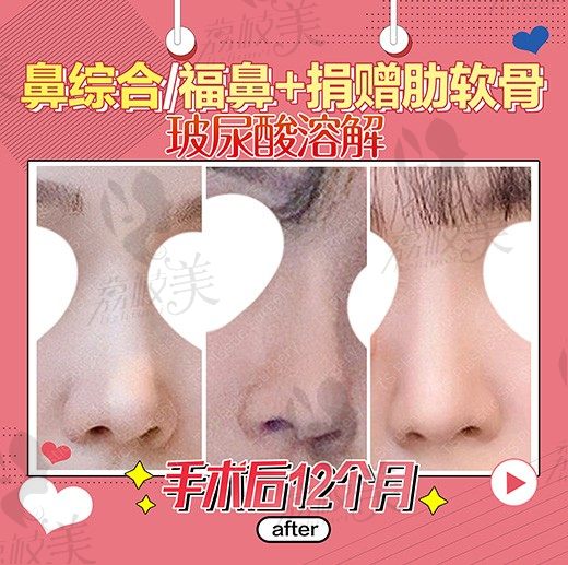 手术后