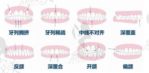 唐山牙博士口腔正畸醫(yī)生楊峰濤醫(yī)術(shù)怎么樣？牙齒矯正價(jià)格貴嗎？