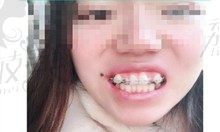 手术前
