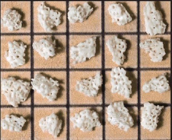 珊瑚骨可以填充面部哪些部位？在重庆北部宽仁30000起就可以做！
