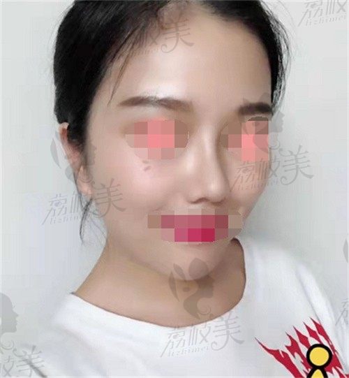 手术后