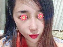 长沙美莱潘卫峰做鼻子怎么样，看我半肋隆鼻真实体验