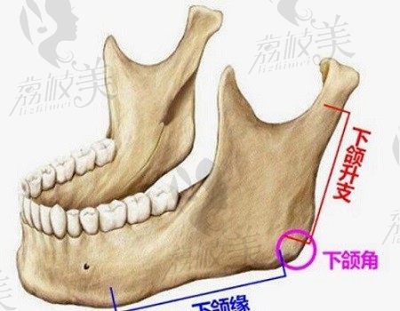张笑天下颌角手术确实好,下颌角截骨劈外板价格5.5w起