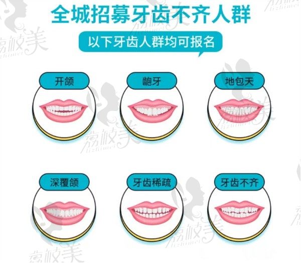 北京劲松口腔价格优惠活动来袭，招募隐形牙套免费体验官