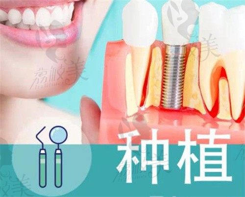 重庆欢乐口腔种牙技术先进，韩国登腾种植牙仅需3300元起