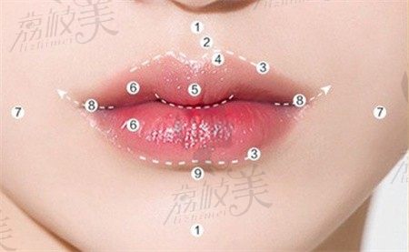 深圳福雅胡俊杰做m唇技术一绝，人中缩短+元宝唇仅需6800元起