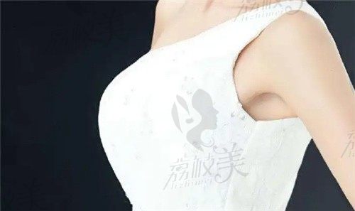 好奇曾昂隆胸多少钱？先来看看他的曼托假体隆胸技术行不行！