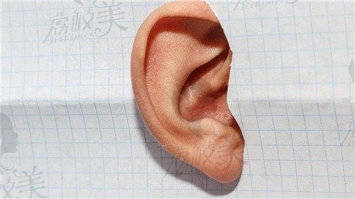 刘嘉锋耳再造技术行不行？起价74800的无植皮全耳再造术效果自然