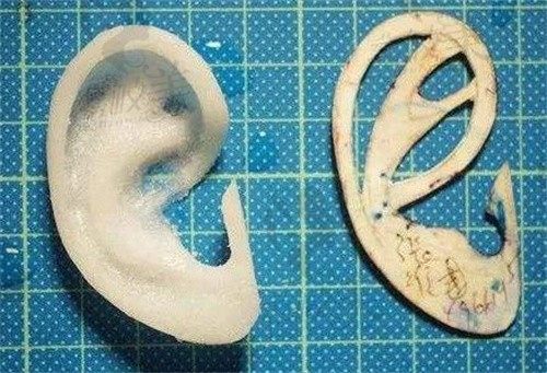 广州余文林耳朵再造技术怎么样？从余文林耳朵再造实力与口碑上分析