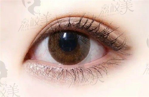 2022武汉眼部整形医院排名前十盘点，都是武汉双眼皮做的好的医院