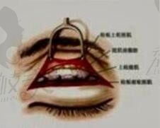 上海杨亚益双眼皮修复怎么样可信吗,修复实例3W多风格还自然